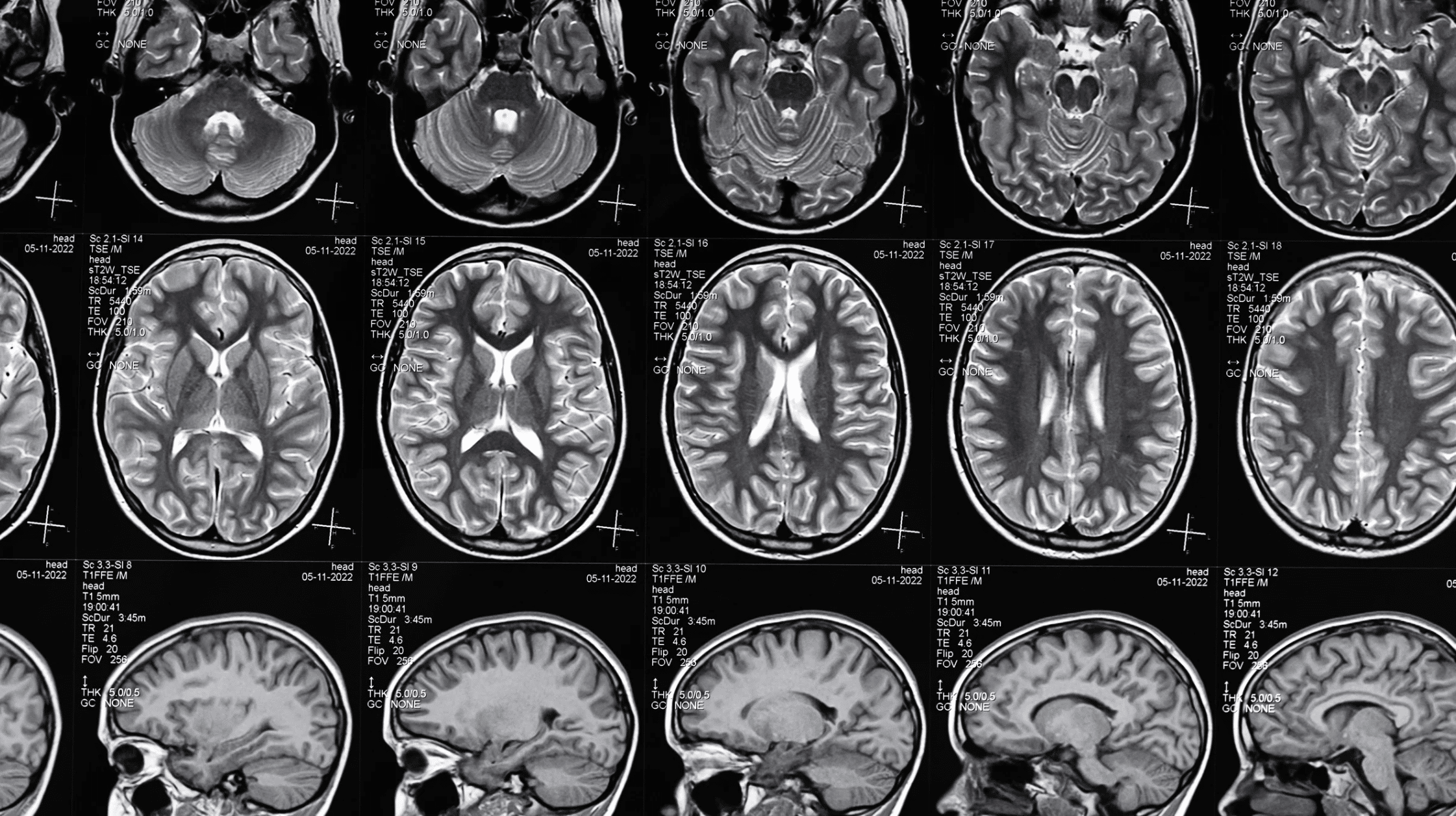 Filing A Brain Injury Claim In Washington DC