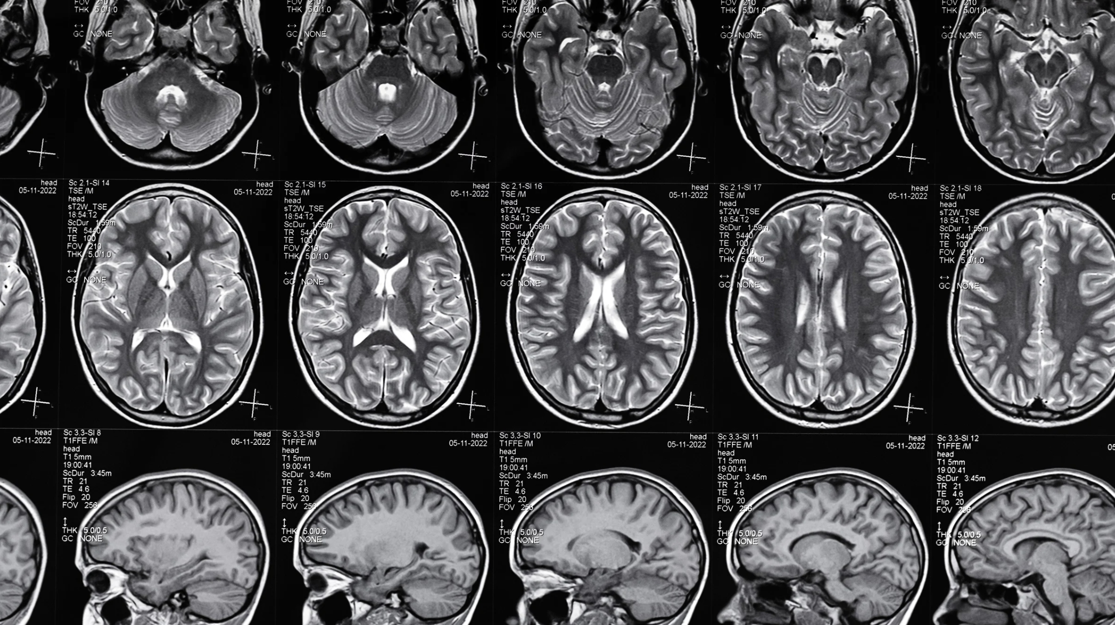 Filing A Brain Injury Claim In Washington DC